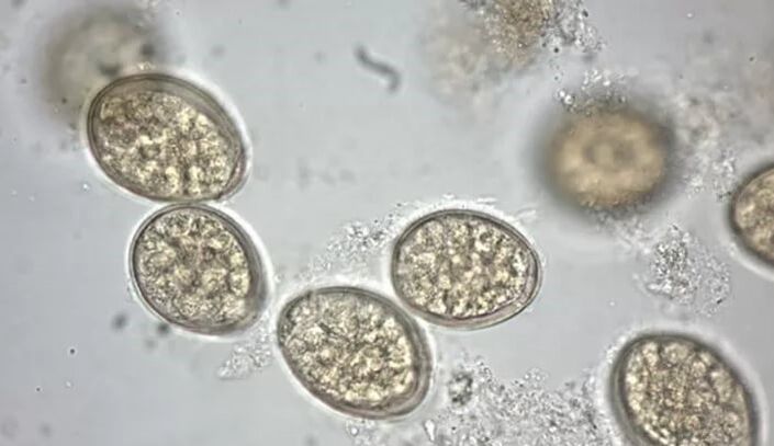 parasit di bawah mikroskop