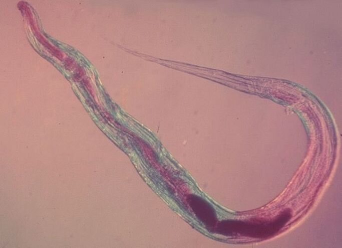 Pinworm di bawah mikroskop
